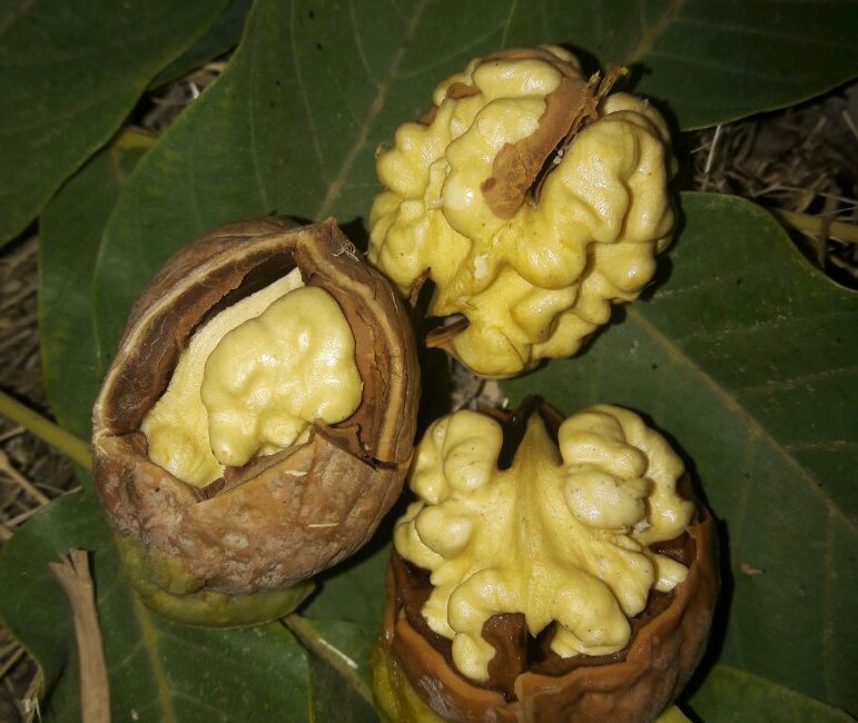 اگر نقرس دارید می توانید گردو مصرف کنید؟